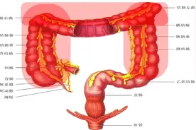 什么是结肠，它的功能是什么？结肠癌确诊的金标准是什么？