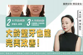 36岁牙周病女性，如何通过隐适美矫正牙齿？恢复健康美观视频封面