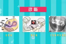 妇产科学：14.2 子宫肌瘤的诊断与治疗视频封面