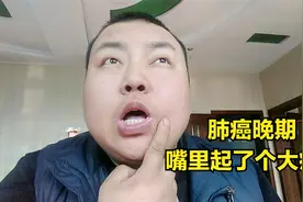 肺癌晚期，我嘴角肉里起了大疙瘩，又把家人吓一跳，现在草木皆兵视频封面
