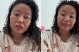 草帽姐感染新冠！脸色惨白头痛欲裂，没吃药没打针躺了一整天视频封面