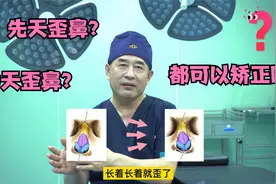 歪鼻的先天和后天都可以矫正吗？视频封面