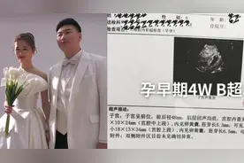 朱之文新儿媳怀孕双胞胎, 晒孕检单宣布喜讯，朱小伟生育能力正常视频封面