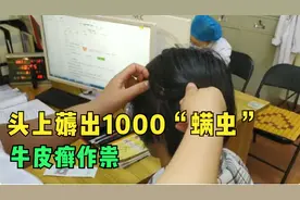 癫痫手术后遗症：江门女头发里薅出1000“螨虫”，牛皮癣狂肆虐