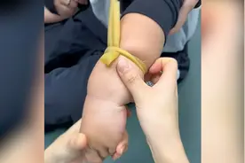 胖娃输液护士展现高超技术，手指摸索几秒定位血管：医院横着走？