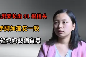 新生男婴长出31根指头，手脚如莲花一般，究竟是什么原因造成的？视频封面