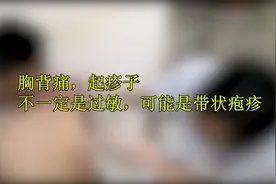 胸背痛，起疹子，不一定是过敏！关于带状疱疹你需要了解这些！视频封面