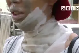 小超市老板销售打火机，测试时爆炸烧伤颈部和脸部视频封面