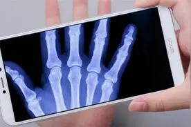 教你用手机开启CT“扫描仪”功能,手上的骨骼都能看的一清二楚视频封面