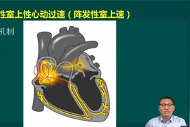 心电图诊断知识（7）阵发性室上速-白文涛老师主讲医师实践技能视频封面