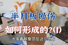 半月板损伤是如何形成的？该怎么避免？肖教授阅片讲解（1）视频封面