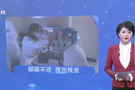 深圳：女子眼睛不舒服，医生挑出2公分长线虫