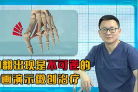 看着就疼！沉浸式体验拇外翻手术，3D动画演示视频封面