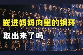 5.4亿人佩戴节育环，又有多少人及时取下？这里面就有我们的妈妈视频封面