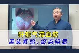 舌头紫暗、瘀点明显，如何行气活血？一招改善肝郁气滞、打通血瘀视频封面