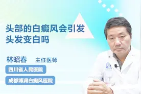 头部的白癜风会导致头发变白吗？医生说出了答案