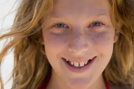 鼻梁、脸颊长斑，是雀斑还是黄褐斑？这样治疗效果好