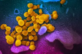 新冠病毒长这样！显微镜彩照首度公布，与SARS病毒十分相似视频封面