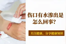 伤口有水渗出是怎么回事？医生提醒：别不重视！