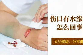 伤口有水渗出是怎么回事？医生提醒：别不重视！视频封面