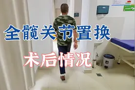 双侧人工全髋关节置换手术后三个月，患者回来复查，情况怎么样？