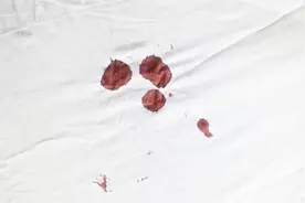 大姨妈黑是不是体内有毒素？医生说和这3种原因有关视频封面