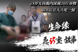 18岁女孩腹内深藏20斤异物，医生直接下手扣拿，众人当场愣在原地视频封面