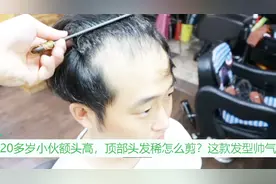 20岁小伙额头高，顶部头发稀少怎么剪？这样剪真帅气