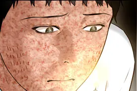 男孩20岁生日愿望竟然是希望自己快点逝去视频封面