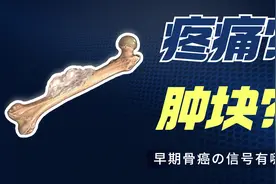 骨癌发作，肢体会出现这样的疼痛，别再当作外伤了！视频封面