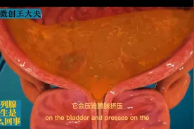 看完这个视频，你就了解了前列腺增生的真相视频封面