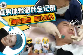 直男体验微针全记录，满脸是血，胆小勿入视频封面