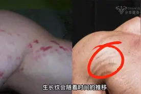 健身增肌期如何避免生长纹【皮下裂纹】视频封面