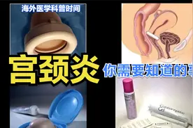 80%的女性一生中都会经历的妇科炎症，有这些症状可能是宫颈炎视频封面