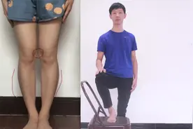 膝盖内扣！小腿外翻！腿不直！重塑腿型只需1招，每天8分钟