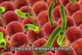 男人太久不排精，会造成4种伤害，无需害羞，为了健康了解下视频封面