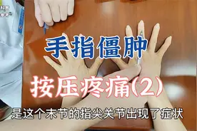 手指关节肿胀僵硬按压疼痛是怎么回事？肖教授查体分析病因（2）视频封面