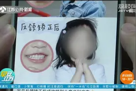 牙齿矫正越早越好？3岁女娃日戴牙套超12个小时，真的有必要吗？