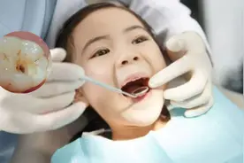 “虫牙”是咋回事，牙齿上长的到底是啥“虫”？今天可算搞清楚了