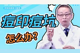 长痘留下难看的痘印痘坑？皮肤科医生教你怎么解决视频封面