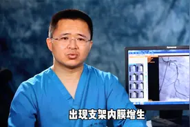 支架术后复查4：术后一年主张复查造影视频封面