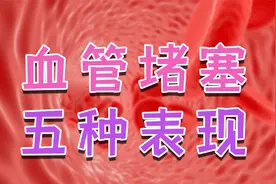 血管不通畅，重要脏器供血不足！这些症状若一个没有，血管很干净视频封面
