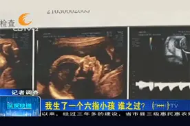 怀孕产检一次都没少却生下六指宝宝，院方：四维超声有局限性视频封面