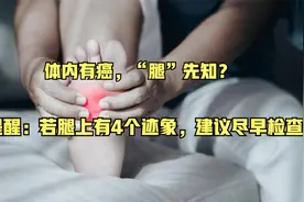 体内有癌，“腿”先知？提醒：若腿上有4个迹象，建议尽早检查CT视频封面