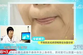 反复出现嘴唇干裂竟有其他隐患？专家给出专业解释，以后要注意视频封面