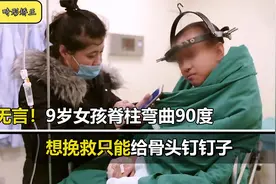 震撼无言！9岁女孩脊柱弯曲90度，想挽救只能给骨头钉钉子视频封面
