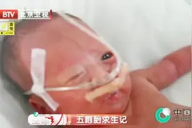 早产五胞胎4：见到4个宝宝，妈妈情绪失控，老二竟发生了呼吸困难视频封面