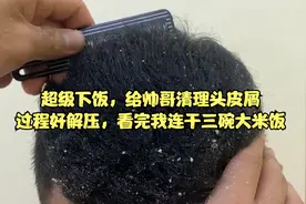 超级下饭，给帅哥清理头皮屑，过程好解压，看完我连干三碗大米饭视频封面