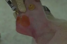 标准猪耳缘静脉采血怎么操作，一起来看看