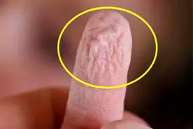 手指在水里泡久了，为什么会起皱？视频封面
